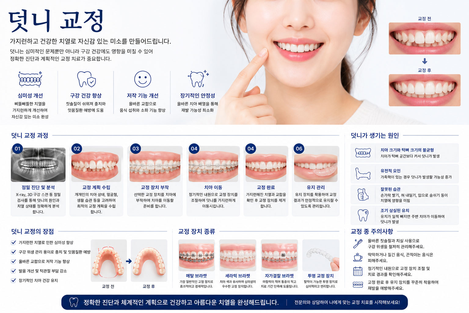 시청역 덧니교정 강북센트럴치과 – 덧니와 삐뚤어진 치열 교정 전 상태