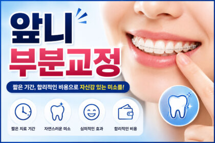 시청역 앞니교정 강북센트럴치과 – 앞니 부분교정 안내